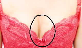 体に合わないブラ