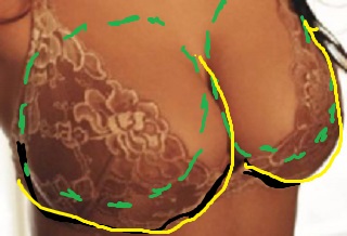 Droopy breasts