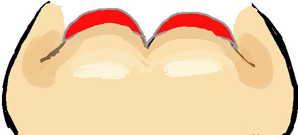 ブラからお肉がはみ出ている