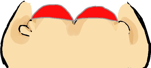 脇肉に段差ができている